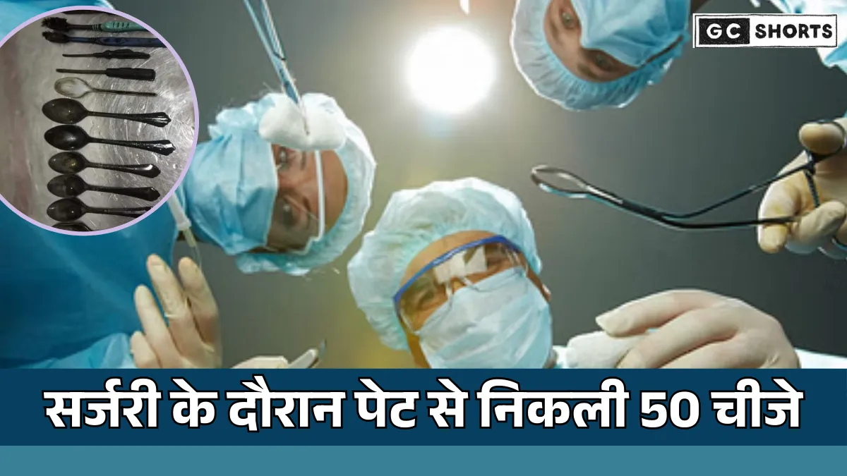 surgery : में खुला बड़ा राज युवक के पेट से निकले 29 चम्मच और 19 टूथब्रश हैरत में है डॉक्टर और परिवार के सदस्य