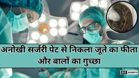 Ahmedabad : 7 साल के बच्चे के पेट से निकला बालों का गुच्छा और जूते का फीता, सफल सर्जरी से बची जान
