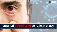 Patna : में गुलाबी आंख तेजी से फैल रहा, बड़े अस्पतालों में 20% मरीज बढ़े