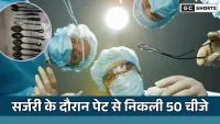 surgery : में खुला बड़ा राज युवक के पेट से निकले 29 चम्मच और 19 टूथब्रश  हैरत में है डॉक्टर और परिवार के सदस्य