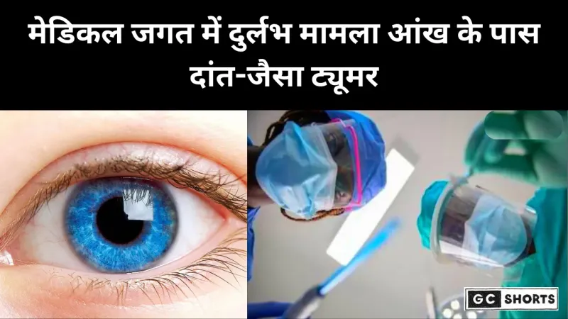 Bihar Me Ek Shaks Ki Aankh Ke Paas Nikla daant: क्या है पूरा मामला और मेडिकल साइंस क्या कहता है
